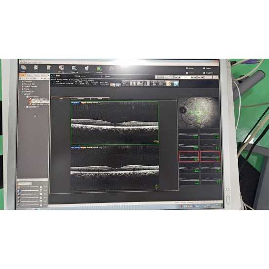 OCT Nidek RS-3000 Advance