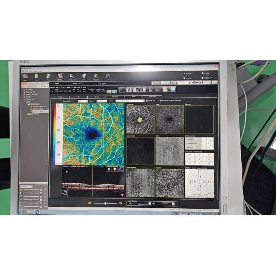 OCT Nidek RS-3000 Advance