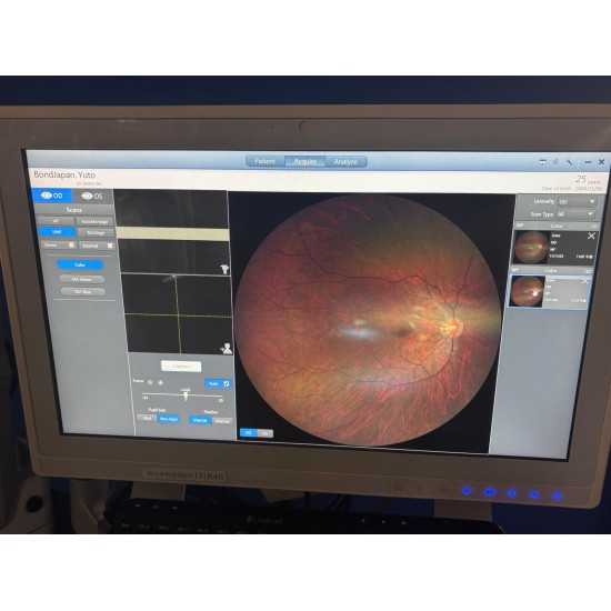 Fundus Camera Zeiss Clarus 500 Fundus Camera Zeiss Clarus 500