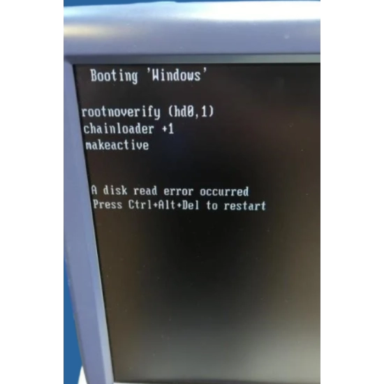 Ultrasuono GE Logiq E9 Premium