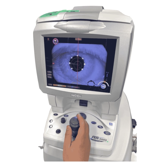 OCT Nidek RS-3000 Advance